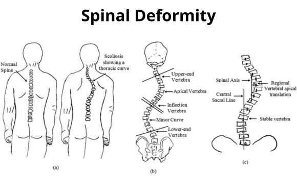 Dr. Sheetal Mohite - best spine surgeon in Mumbai