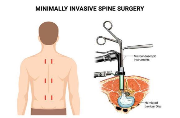 Spine Specialist in Thane - Dr. Priyank Patel