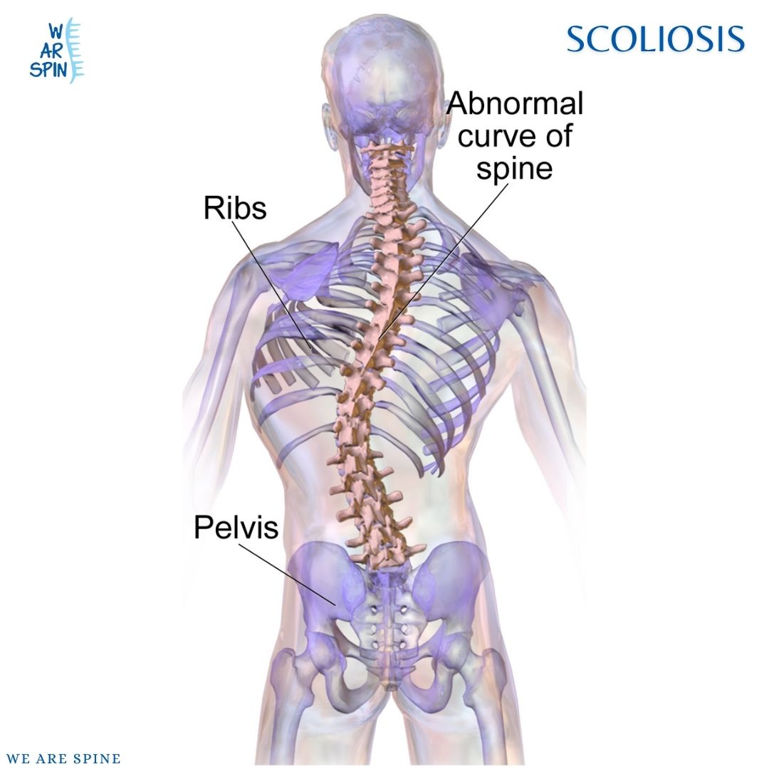 Best Spine Surgeons in Mumbai