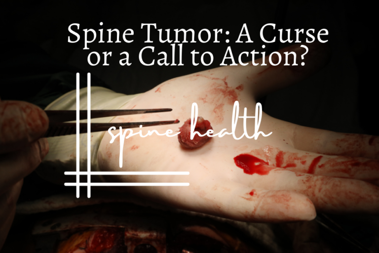 Spine Tumor