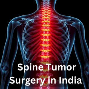 Spine tumor surgery in India 