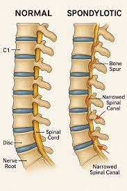 Cervical Spine