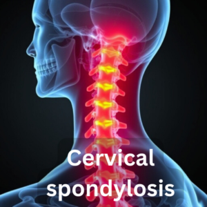 Cervical Spondylosis: Understanding Symptoms, Causes, and Treatment Options