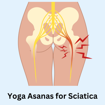 image of Yoga Asanas for sciatica