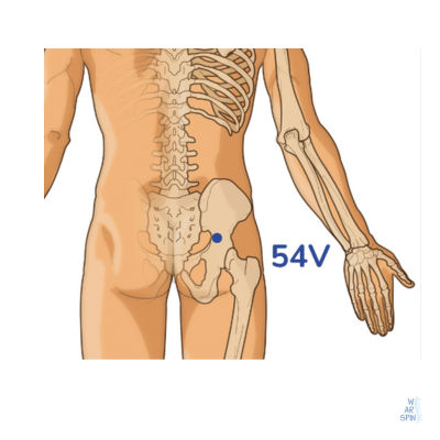 Accurate position of BL54 point to alleviate sciatica nerve pressure.