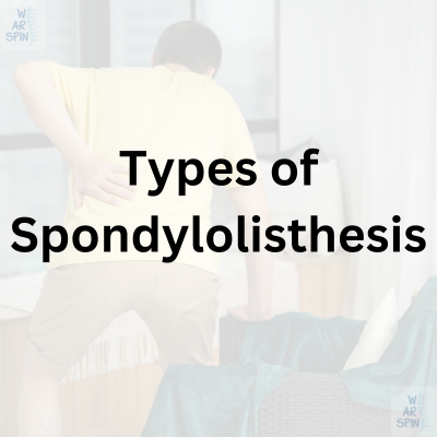 llustration highlighting different types of spondylolisthesis, including congenital, isthmic, and degenerative causes.