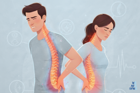 Best Treatment for Slip Disc in India