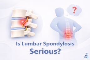 Is Lumbar Spondylosis Serious