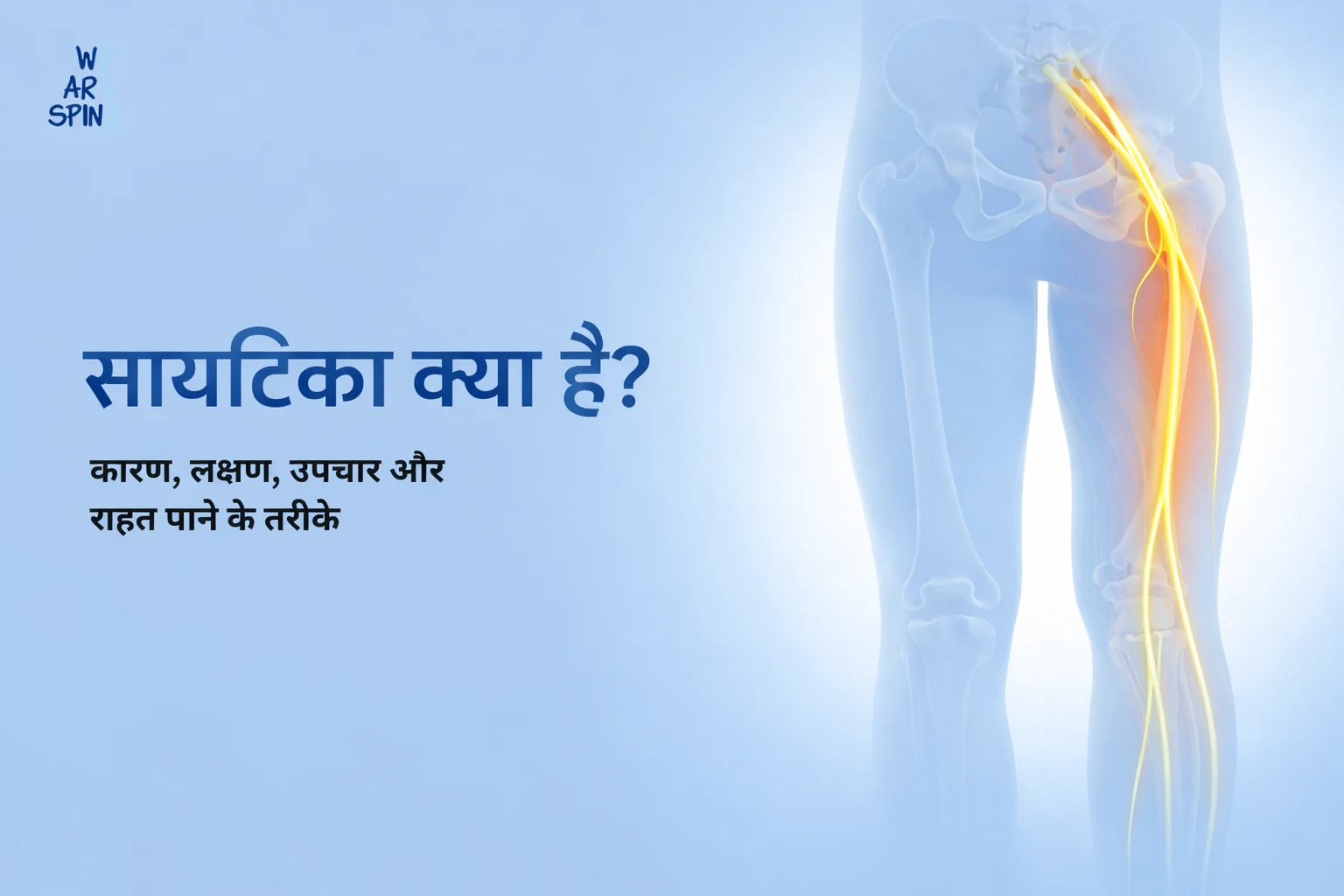 सायटिका