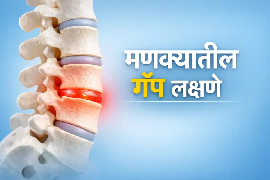 मणक्यातील गॅप लक्षणे