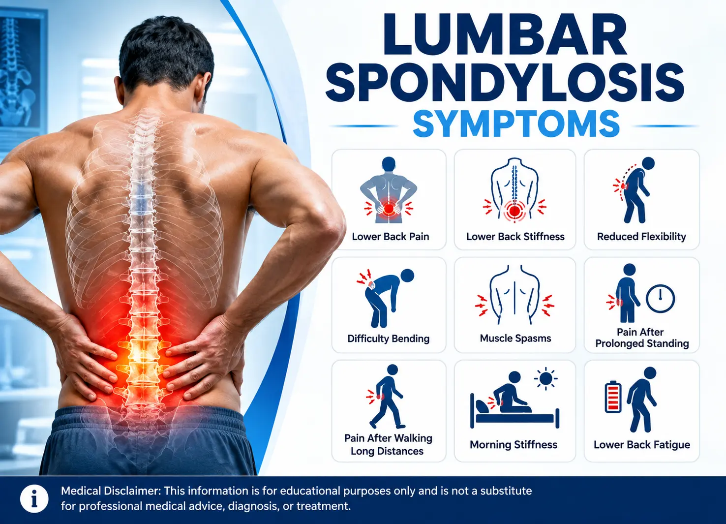 Lumbar Spondylosis Symptoms